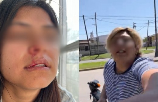 "Te voy a matar por negra bolita": una mujer golpeó a su exnuera y le quiso robar el celular